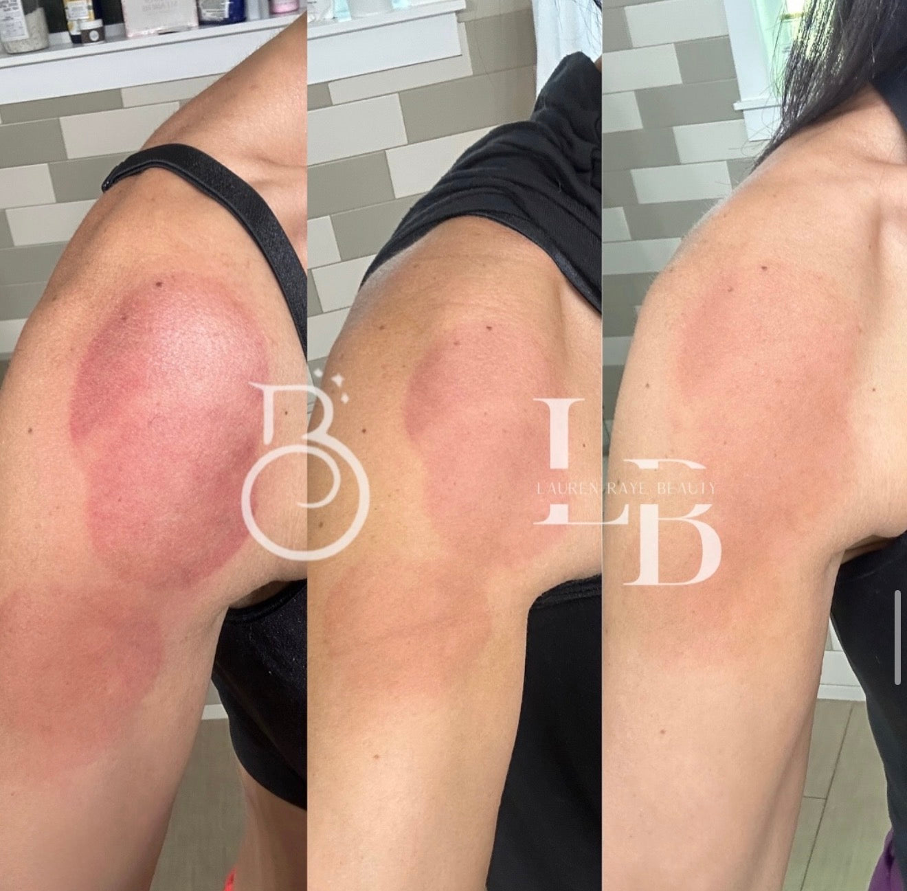 Before-and-after professional skincare result
