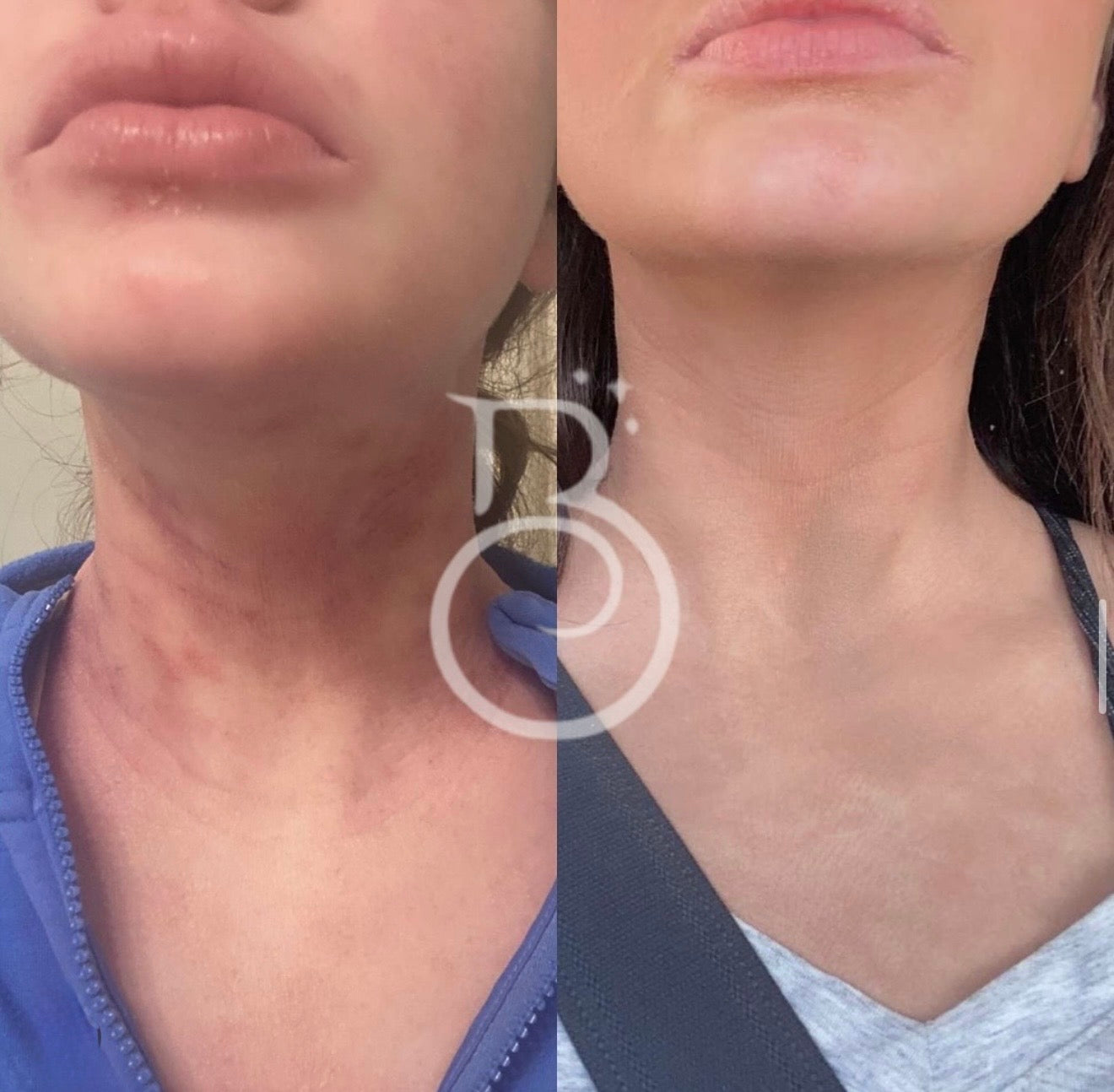 Before-and-after corrective skincare result